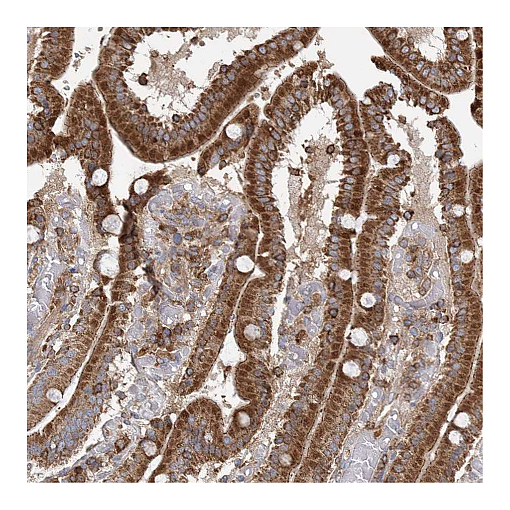 Atlas Antibodies Anti-PLEKHA7 Antibody