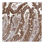 Atlas Antibodies Anti-PLEKHA7 Antibody
