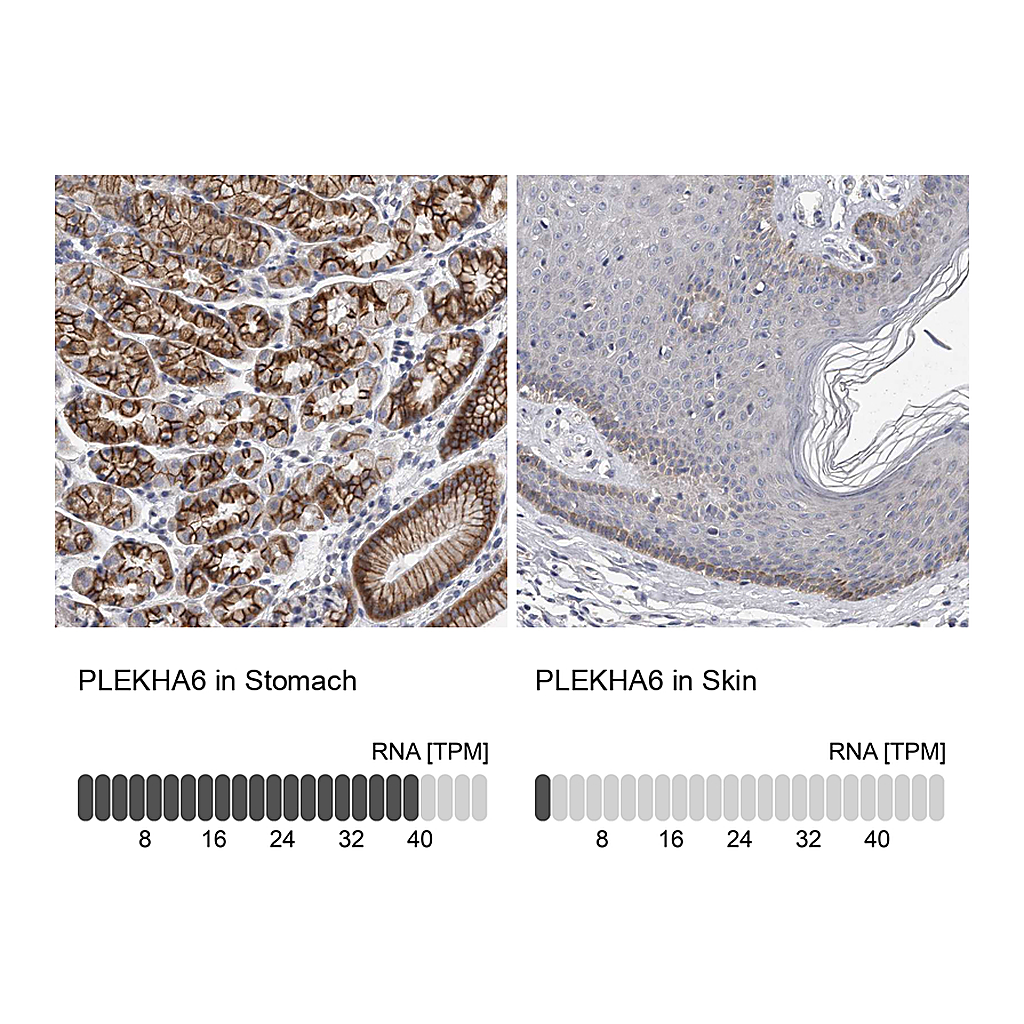 Atlas Antibodies Anti-PLEKHA6 Antibody