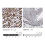 Atlas Antibodies Anti-PLEKHA6 Antibody
