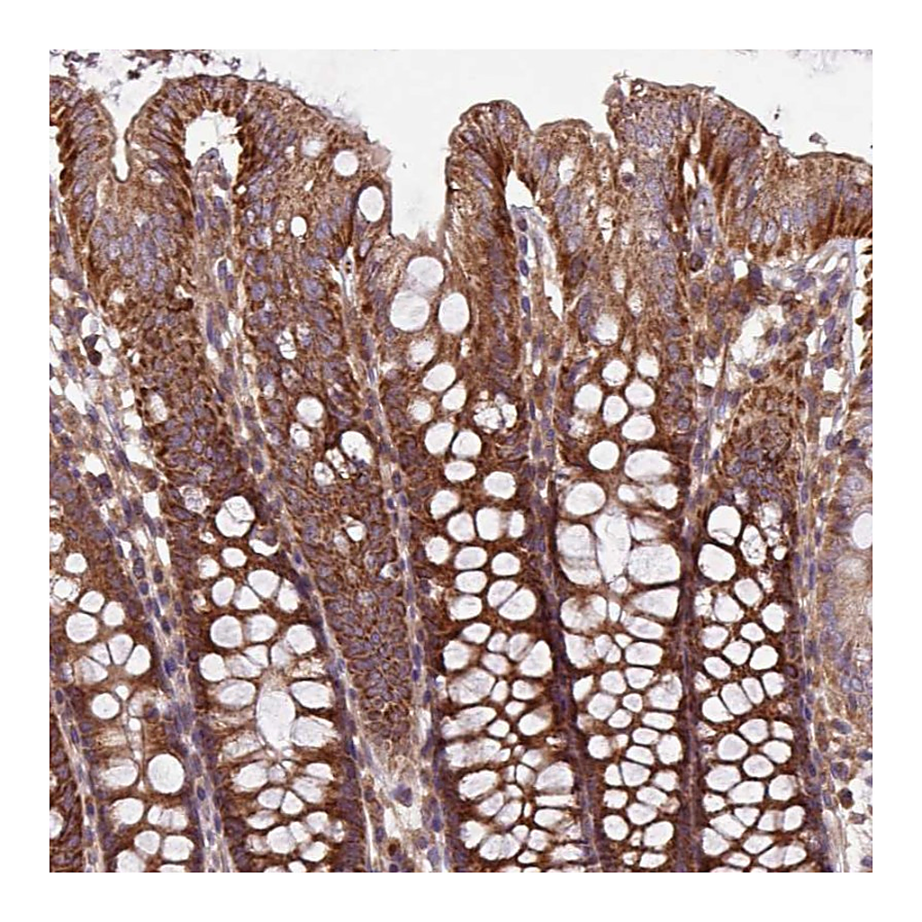 Atlas Antibodies Anti-PLEKHD1 Antibody