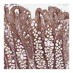 Atlas Antibodies Anti-PLEKHD1 Antibody