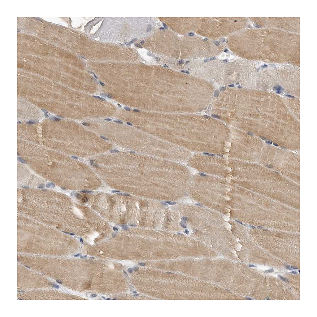 Atlas Antibodies Anti-PLEKHF1 Antibody