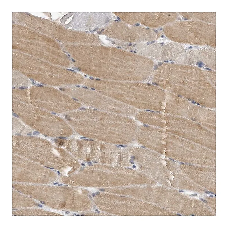 Atlas Antibodies Anti-PLEKHF1 Antibody