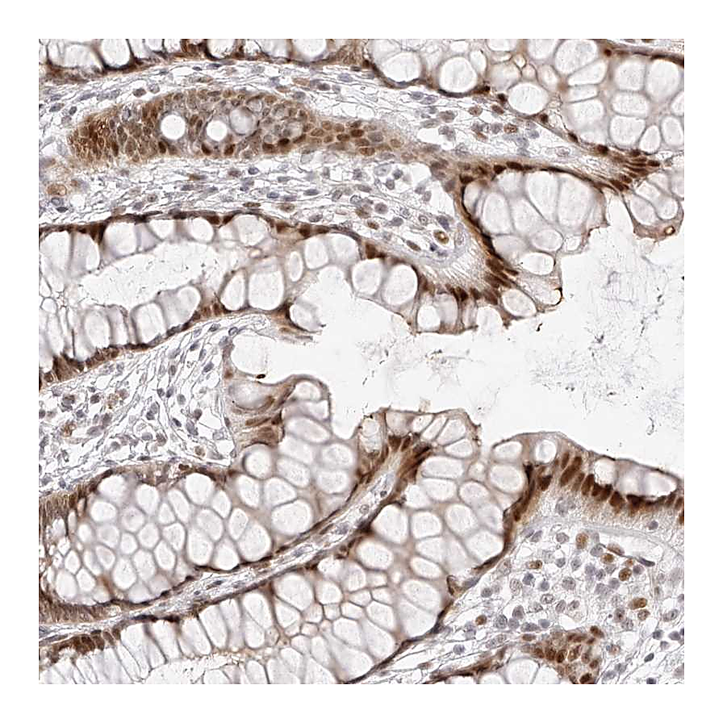 Atlas Antibodies Anti-PLEKHG1 Antibody