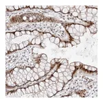 Atlas Antibodies Anti-PLEKHG1 Antibody