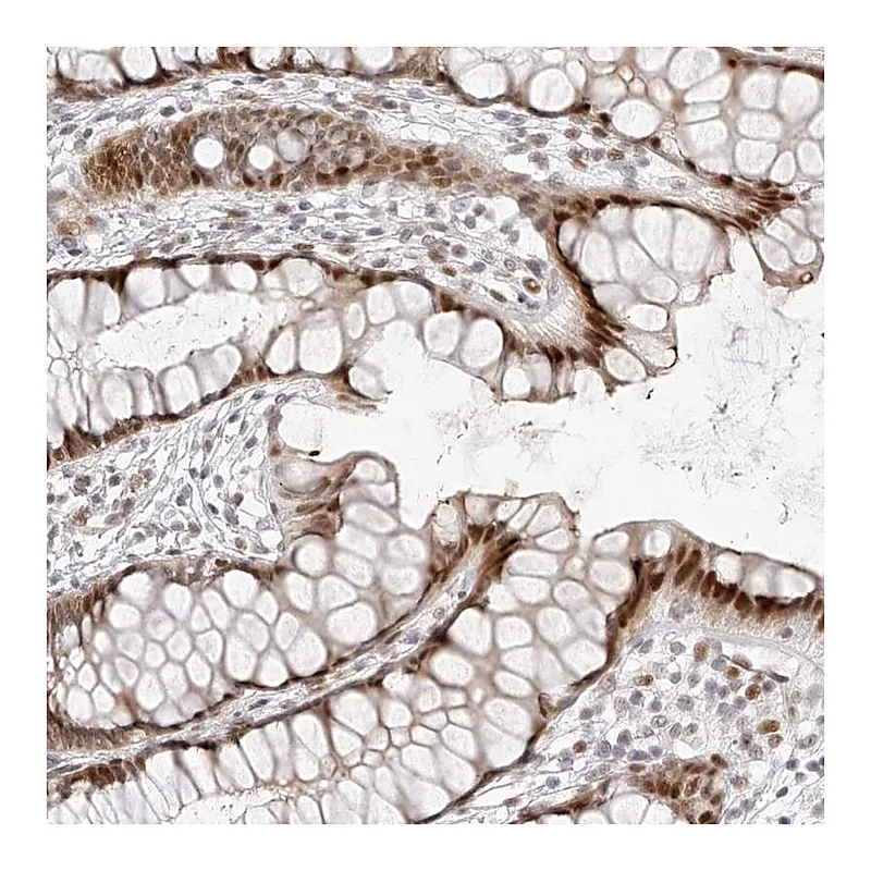 Atlas Antibodies Anti-PLEKHG1 Antibody