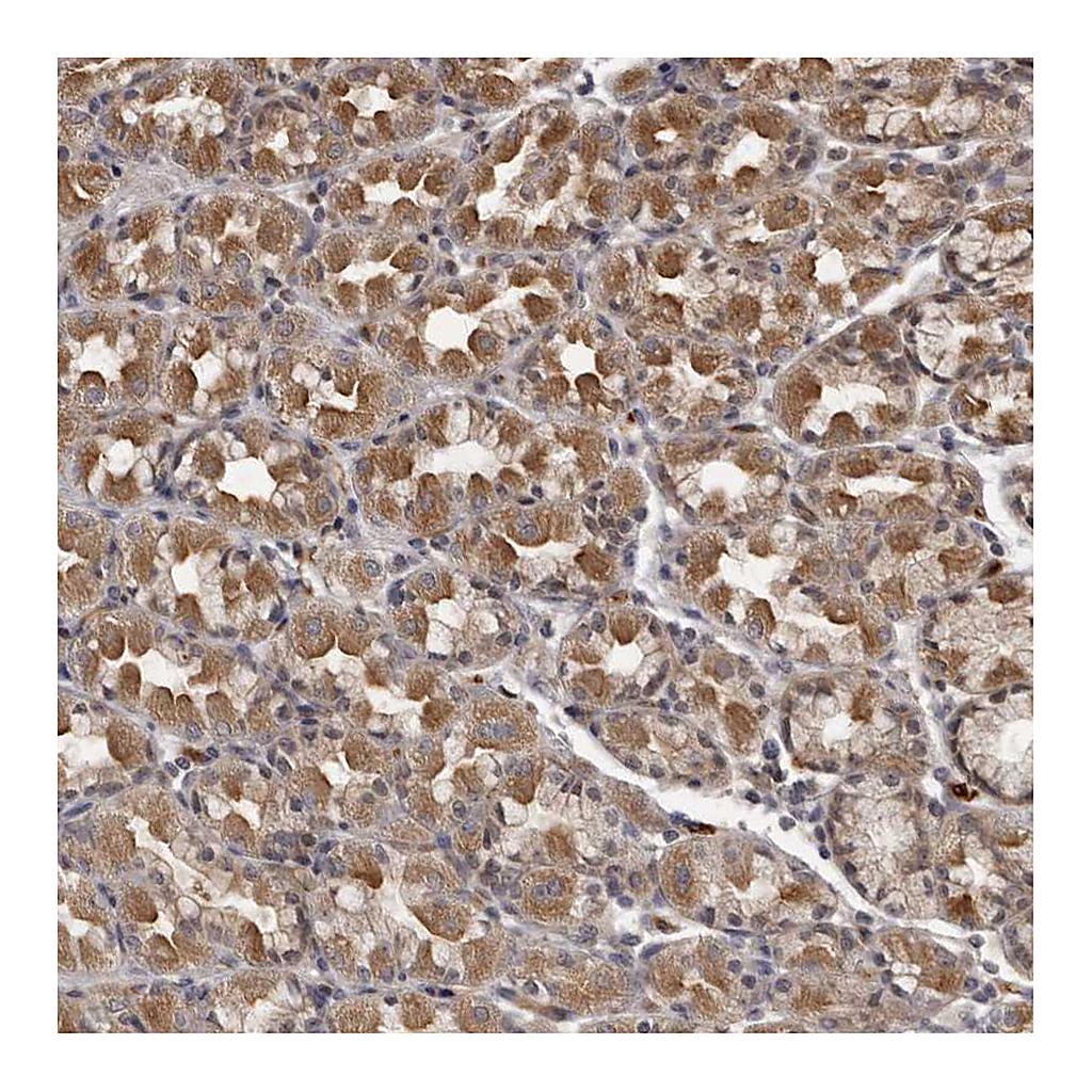 Atlas Antibodies Anti-PLEKHF2 Antibody