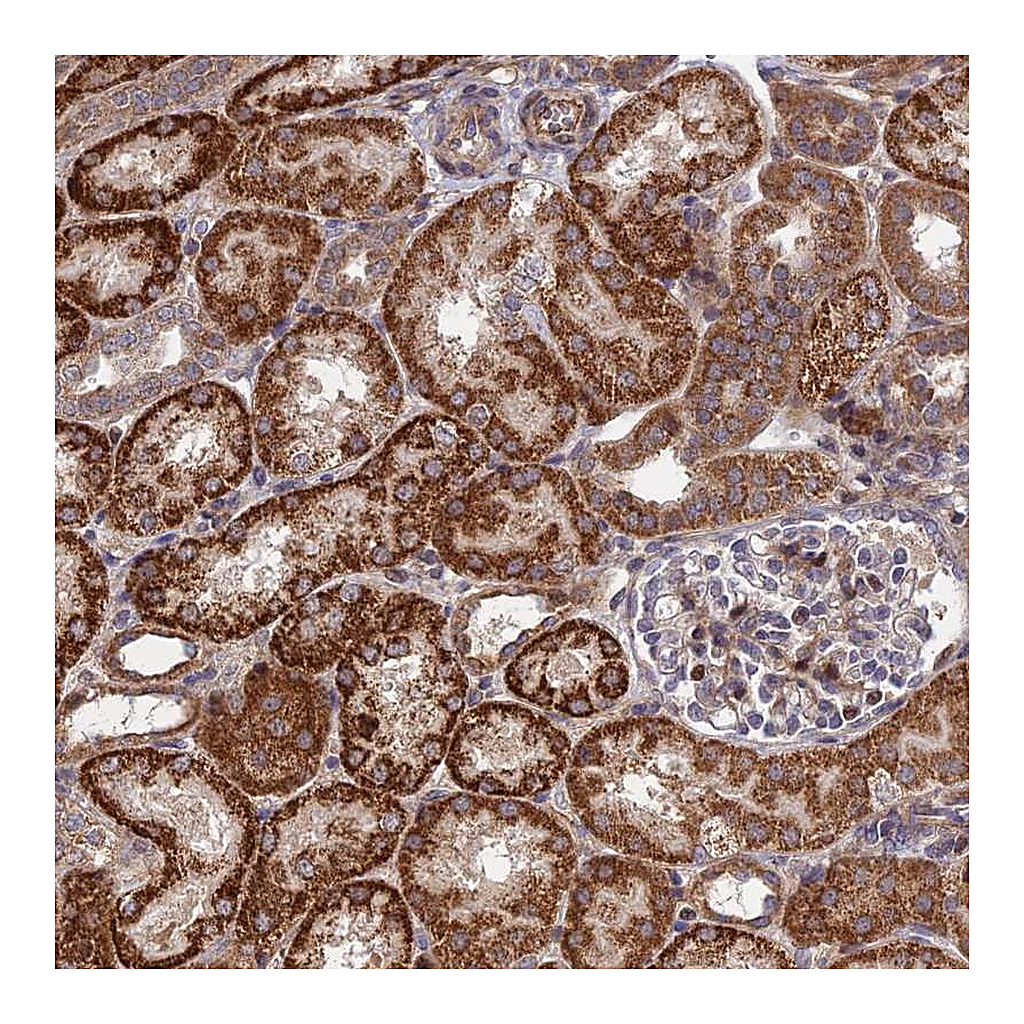 Atlas Antibodies Anti-PLEKHG2 Antibody