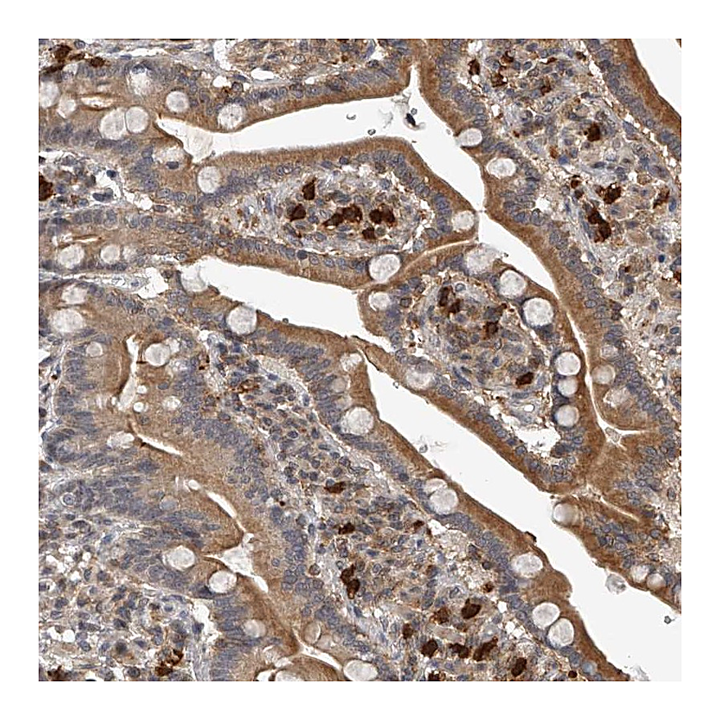 Atlas Antibodies Anti-PLEKHG1 Antibody