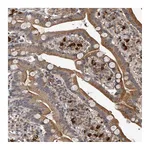 Atlas Antibodies Anti-PLEKHG1 Antibody