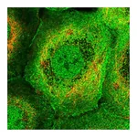 Atlas Antibodies Anti-PLEKHG3 Antibody