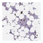 Atlas Antibodies Anti-PLEKHG2 Antibody