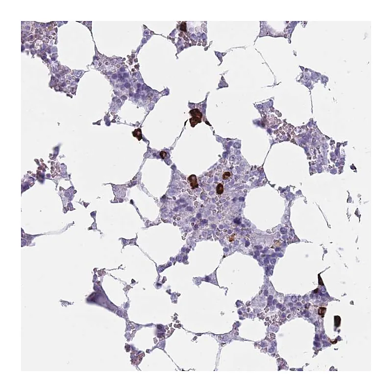 Atlas Antibodies Anti-PLEKHG2 Antibody