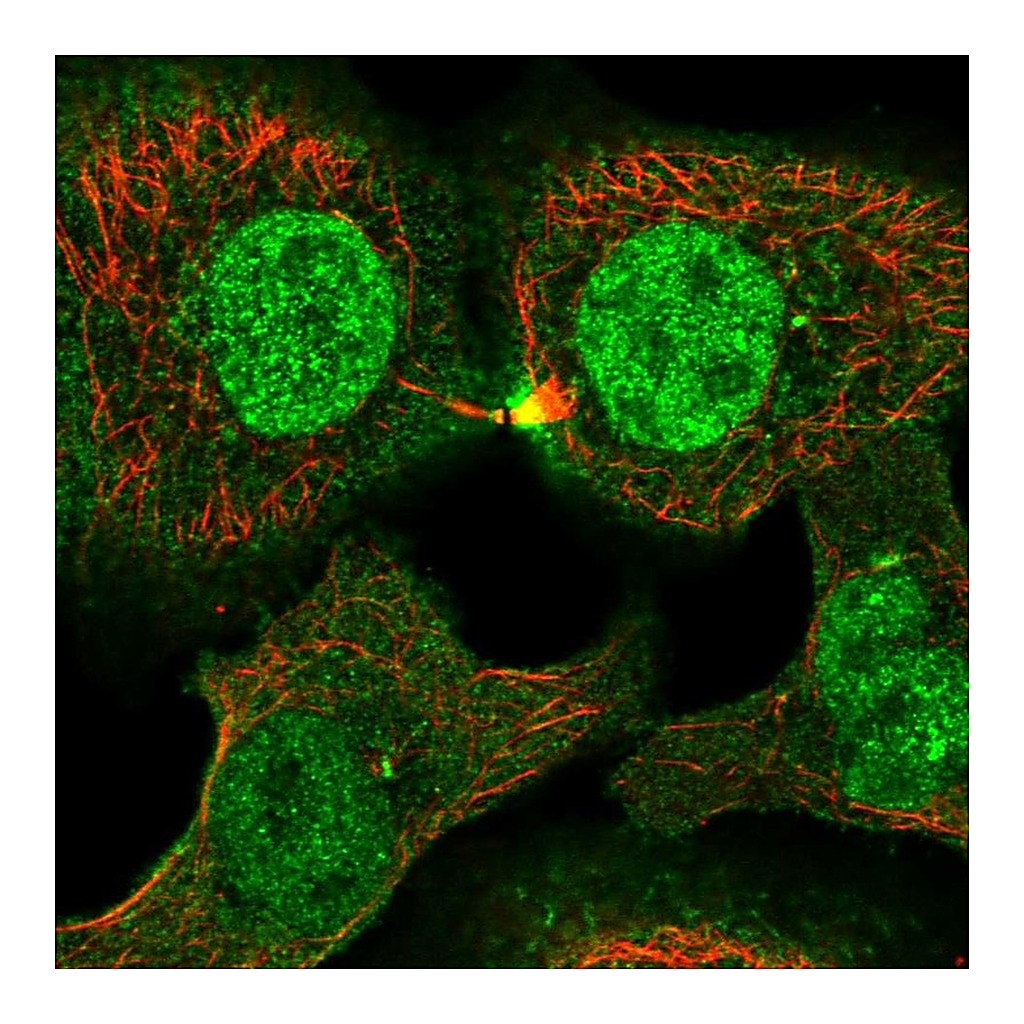 Atlas Antibodies Anti-PLEKHG3 Antibody