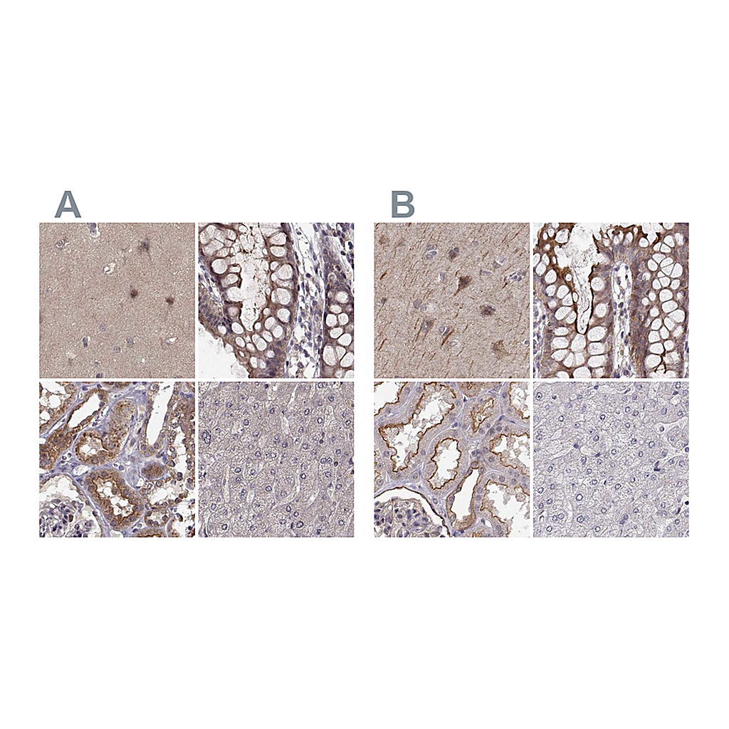 Atlas Antibodies Anti-PLEKHG3 Antibody