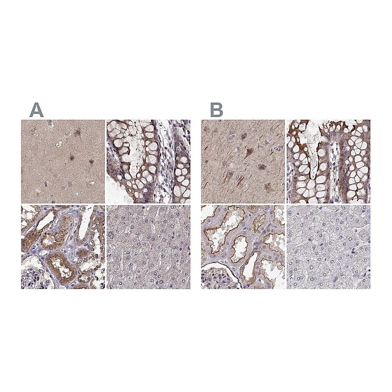 Atlas Antibodies Anti-PLEKHG3 Antibody