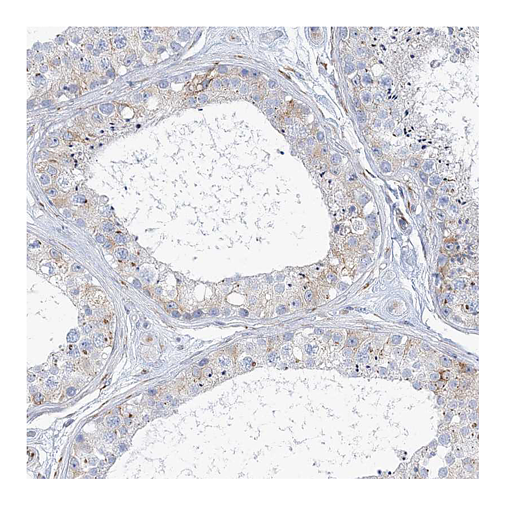 Atlas Antibodies Anti-PLEKHG4B Antibody