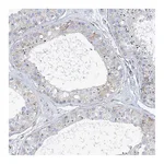 Atlas Antibodies Anti-PLEKHG4B Antibody