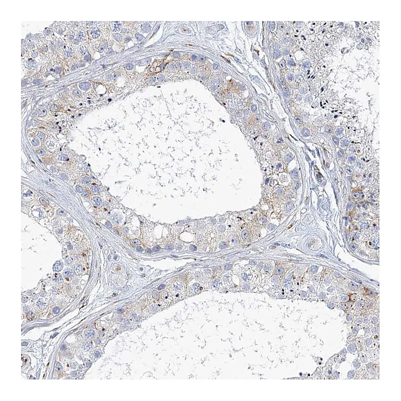 Atlas Antibodies Anti-PLEKHG4B Antibody