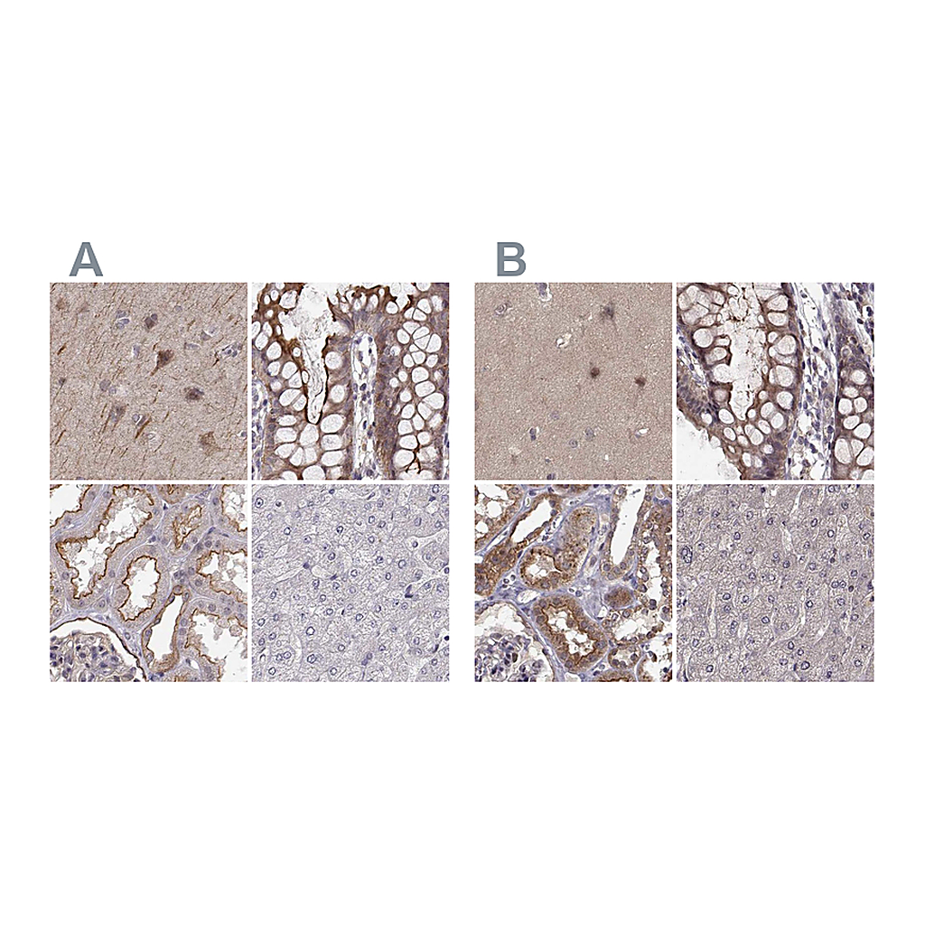 Atlas Antibodies Anti-PLEKHG3 Antibody