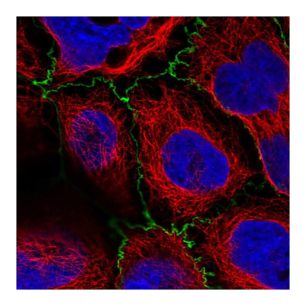 Atlas Antibodies Anti-PLEKHG6 Antibody