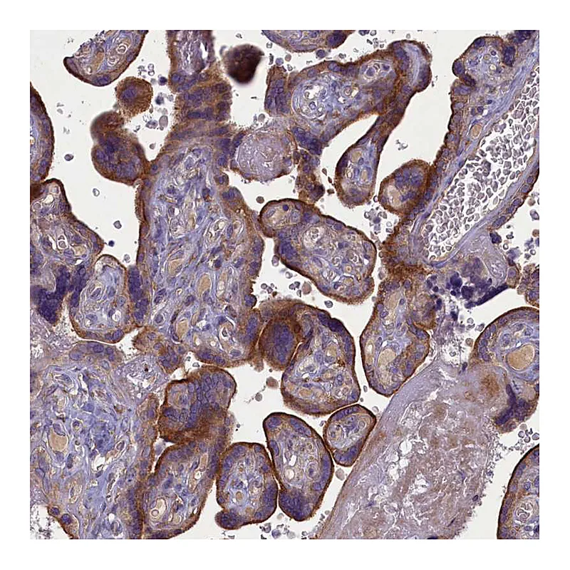 Atlas Antibodies Anti-PLEKHG6 Antibody