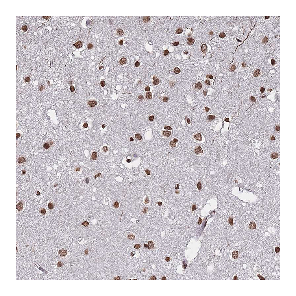 Atlas Antibodies Anti-PLEKHG5 Antibody