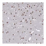 Atlas Antibodies Anti-PLEKHG5 Antibody