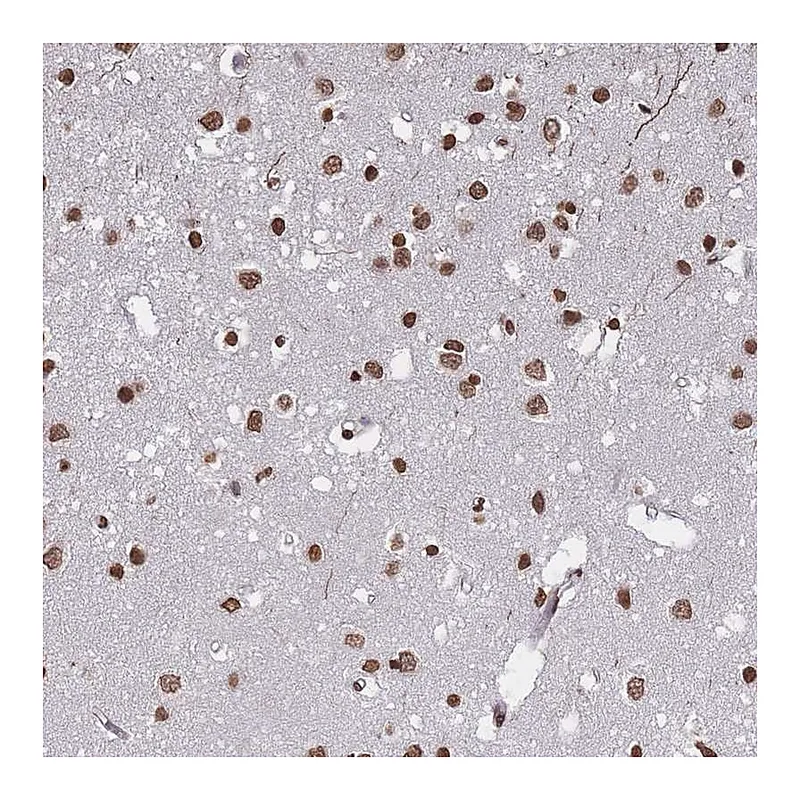 Atlas Antibodies Anti-PLEKHG5 Antibody