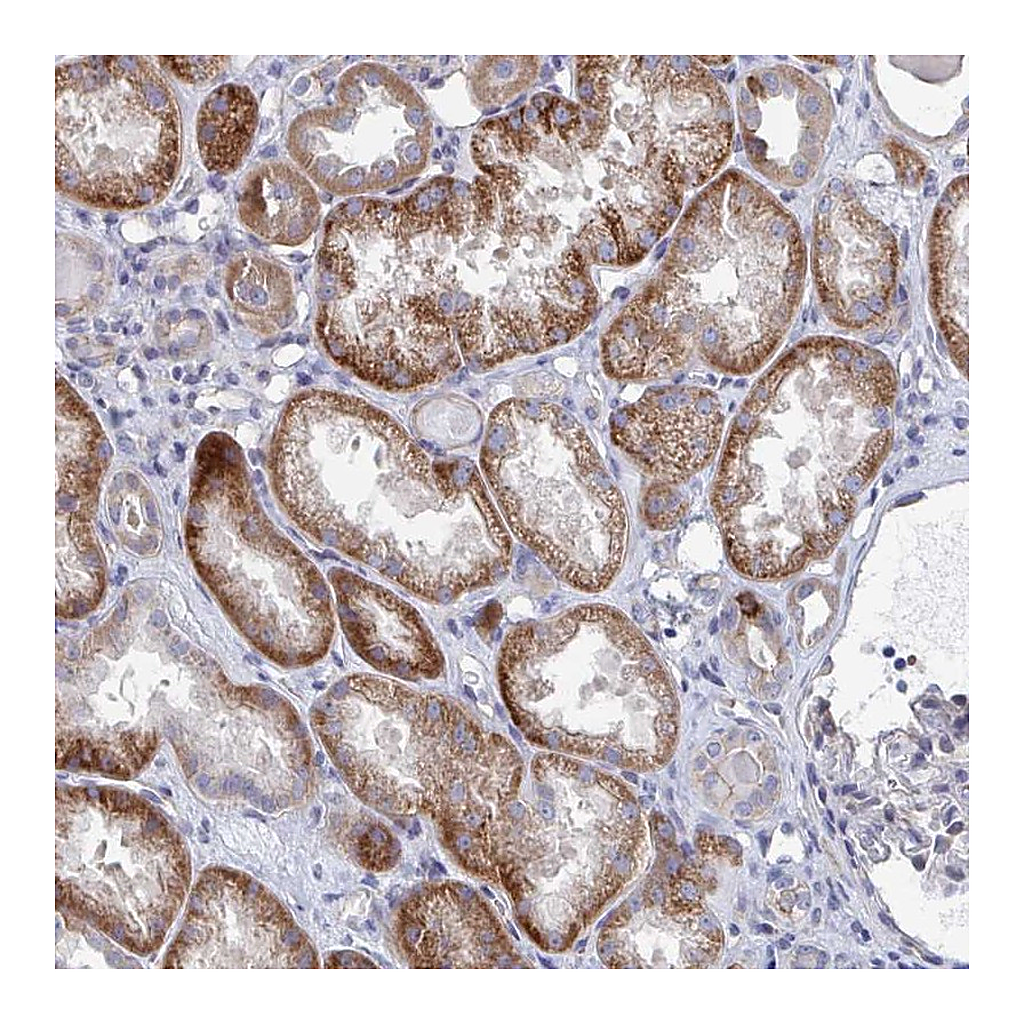 Atlas Antibodies Anti-PLEKHG7 Antibody