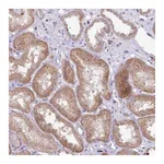 Atlas Antibodies Anti-PLEKHH3 Antibody