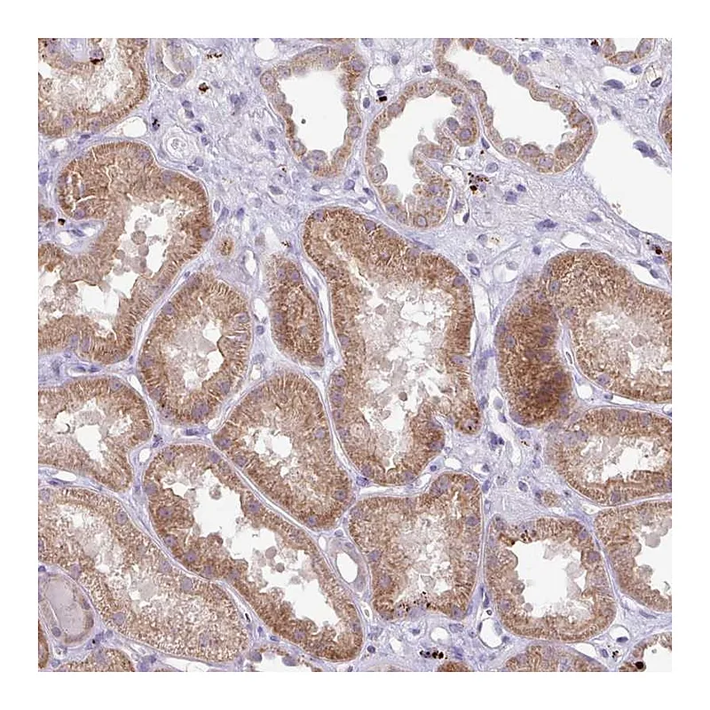 Atlas Antibodies Anti-PLEKHH3 Antibody
