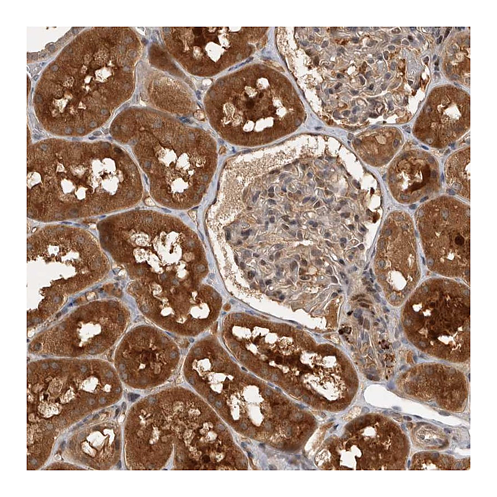Atlas Antibodies Anti-PLEKHM1 Antibody