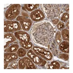 Atlas Antibodies Anti-PLEKHM1 Antibody