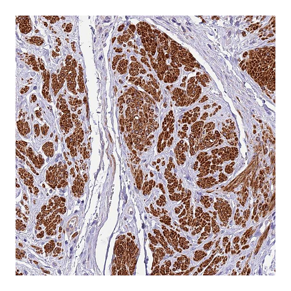 Atlas Antibodies Anti-PLEKHH1 Antibody