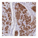 Atlas Antibodies Anti-PLEKHH1 Antibody