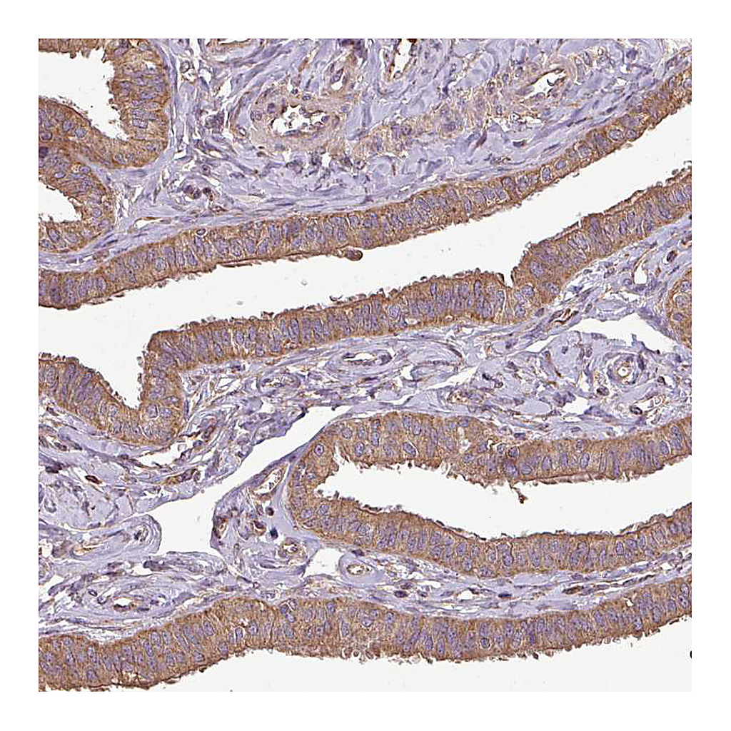 Atlas Antibodies Anti-PLEKHM1 Antibody