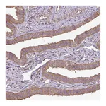 Atlas Antibodies Anti-PLEKHM1 Antibody