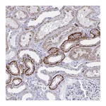 Atlas Antibodies Anti-PLEKHH1 Antibody