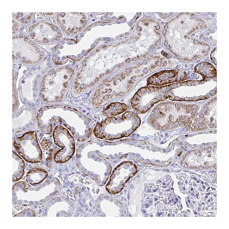 Atlas Antibodies Anti-PLEKHH1 Antibody