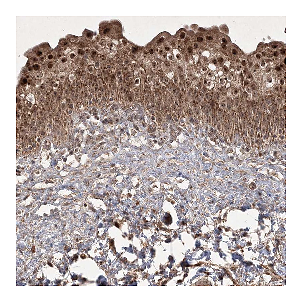 Atlas Antibodies Anti-PLEKHM2 Antibody