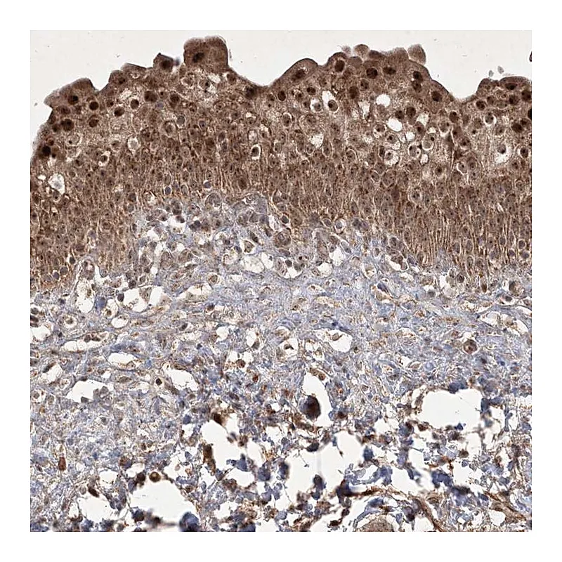 Atlas Antibodies Anti-PLEKHM2 Antibody