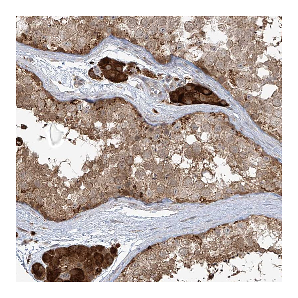 Atlas Antibodies Anti-PLEKHM3 Antibody
