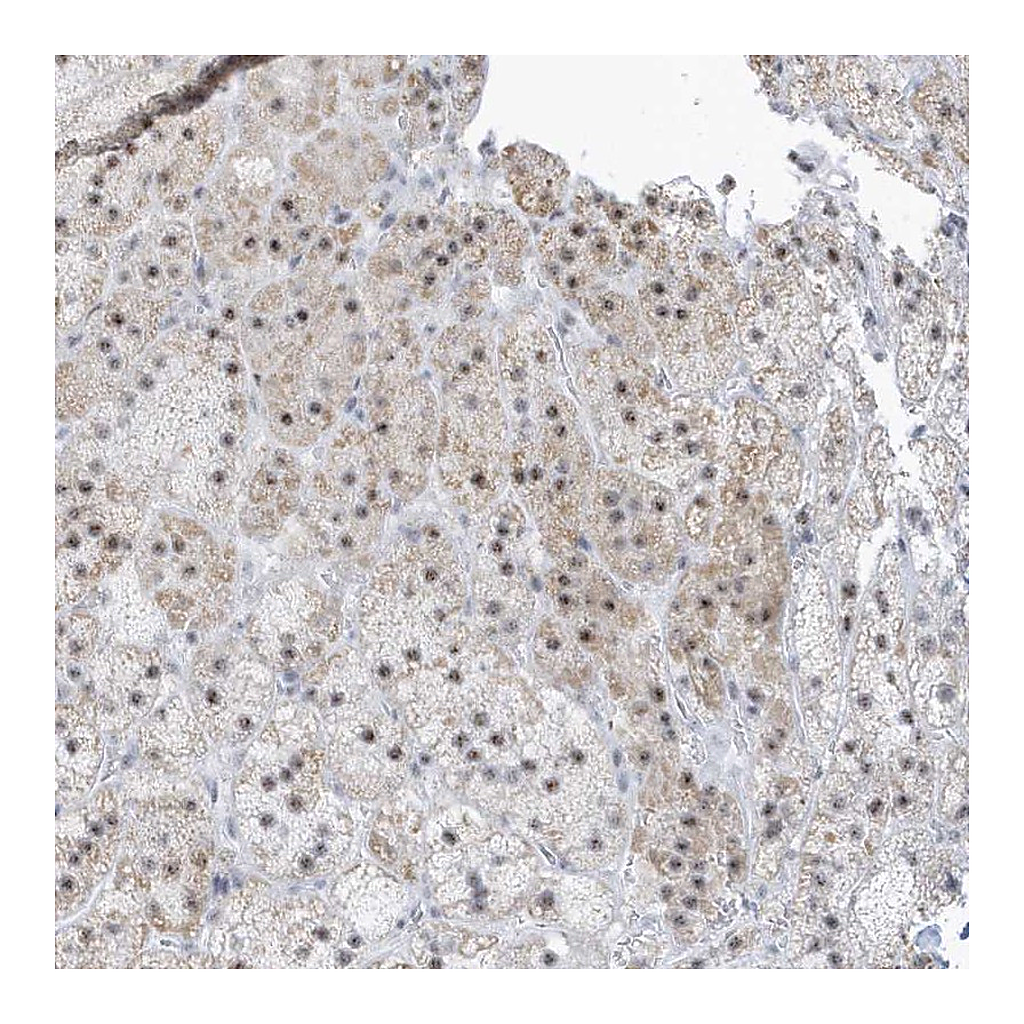 Atlas Antibodies Anti-PLEKHN1 Antibody
