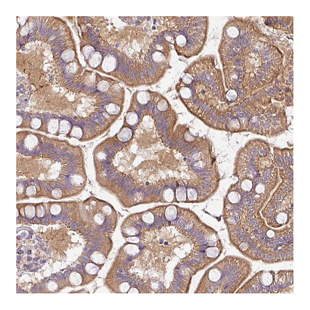 Atlas Antibodies Anti-PLEKHJ1 Antibody