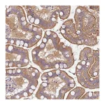 Atlas Antibodies Anti-PLEKHJ1 Antibody