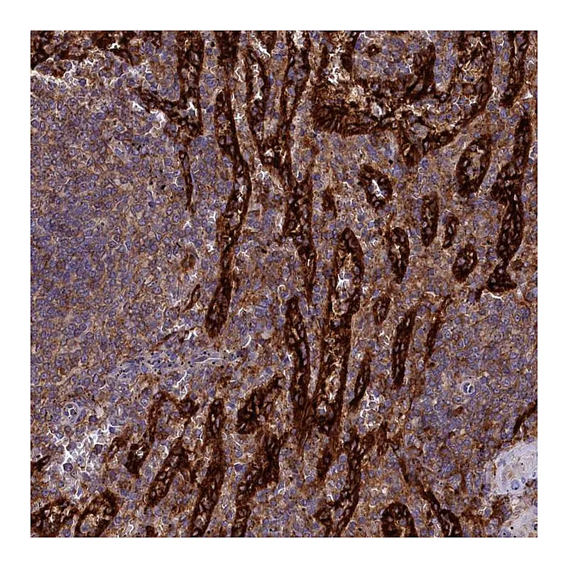 Atlas Antibodies Anti-PLEKHO2 Antibody