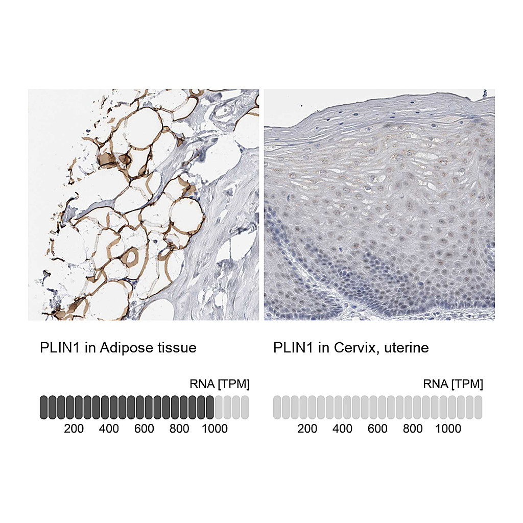 Atlas Antibodies Anti-PLIN1 Antibody