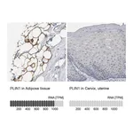 Atlas Antibodies Anti-PLIN1 Antibody